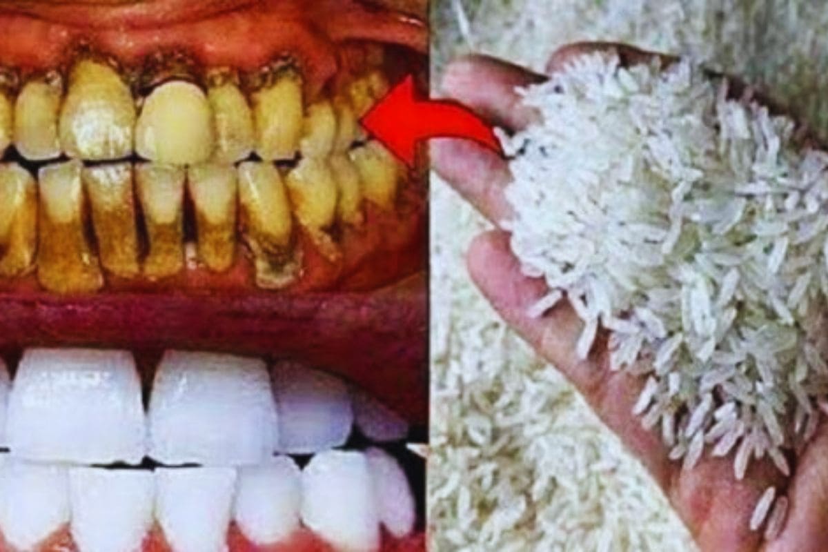 É melhor que lentes nos dentes meu patrão é dentista me ensinou