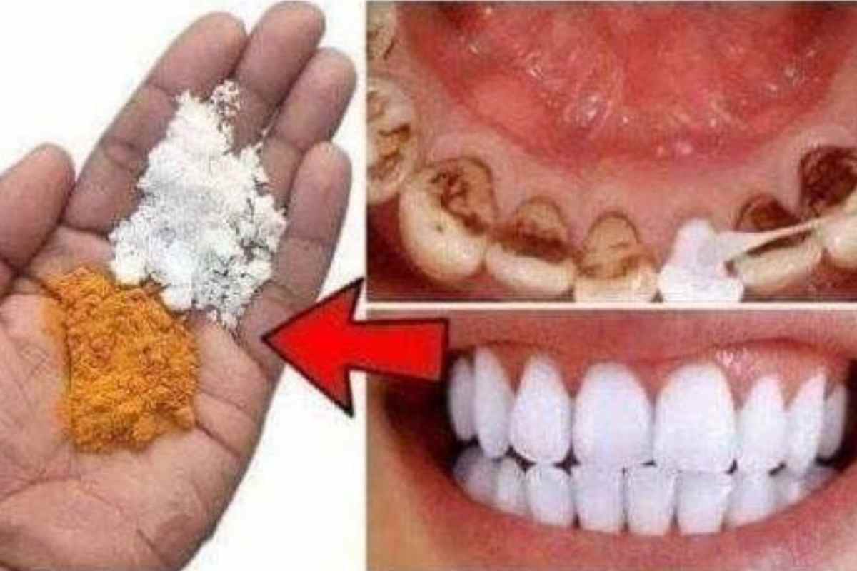 Como Clarear Seus Dentes em Apenas 2 Minutos