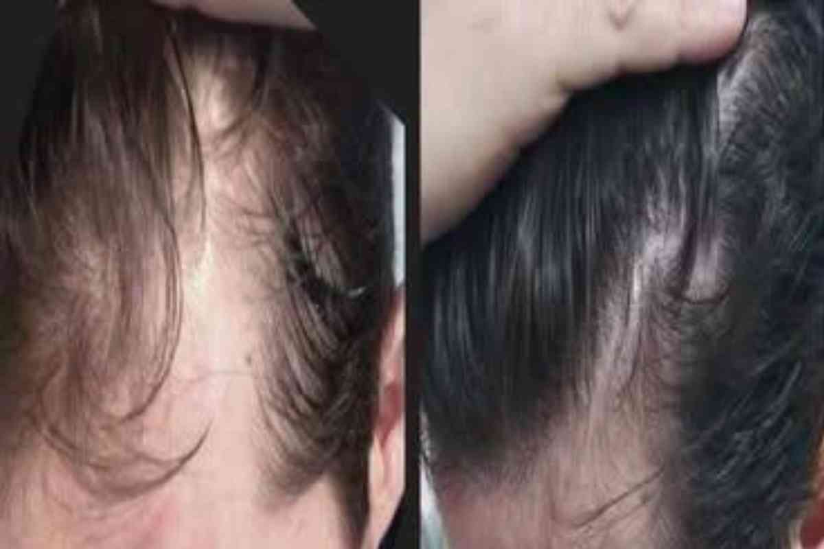 Dicas Poderosas para o Cabelo Crescer Mais Rápido, Forte e Saudável