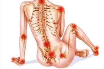 Pontos Sensíveis da Fibromialgia! Entenda Como Lidar com Eles