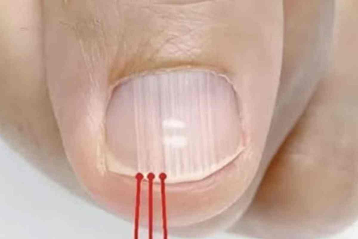 Suas Unhas Revelam Mais do que Você Imagina sobre seu corpo