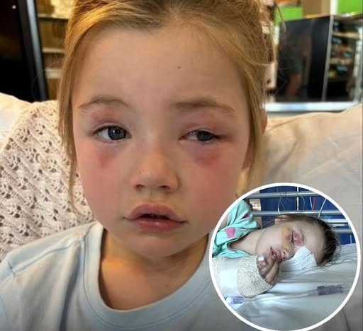 Cápsula de Sabão Deixa Garotinha Cega de um Olho