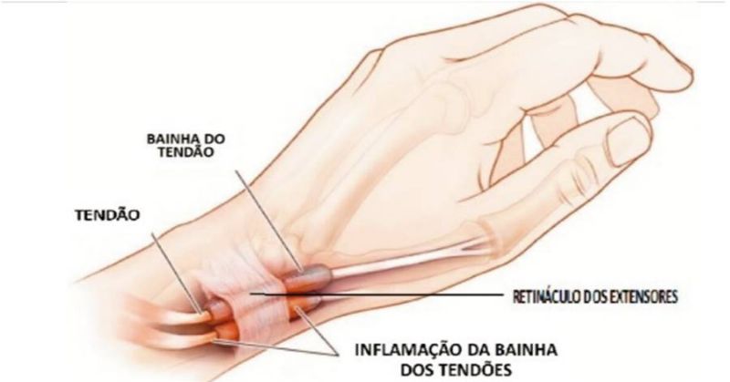 Imagem da Receita