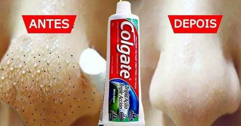 Imagem da Receita