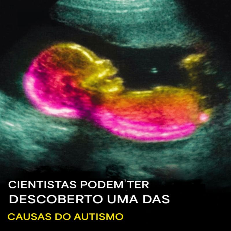 Imagem da Receita