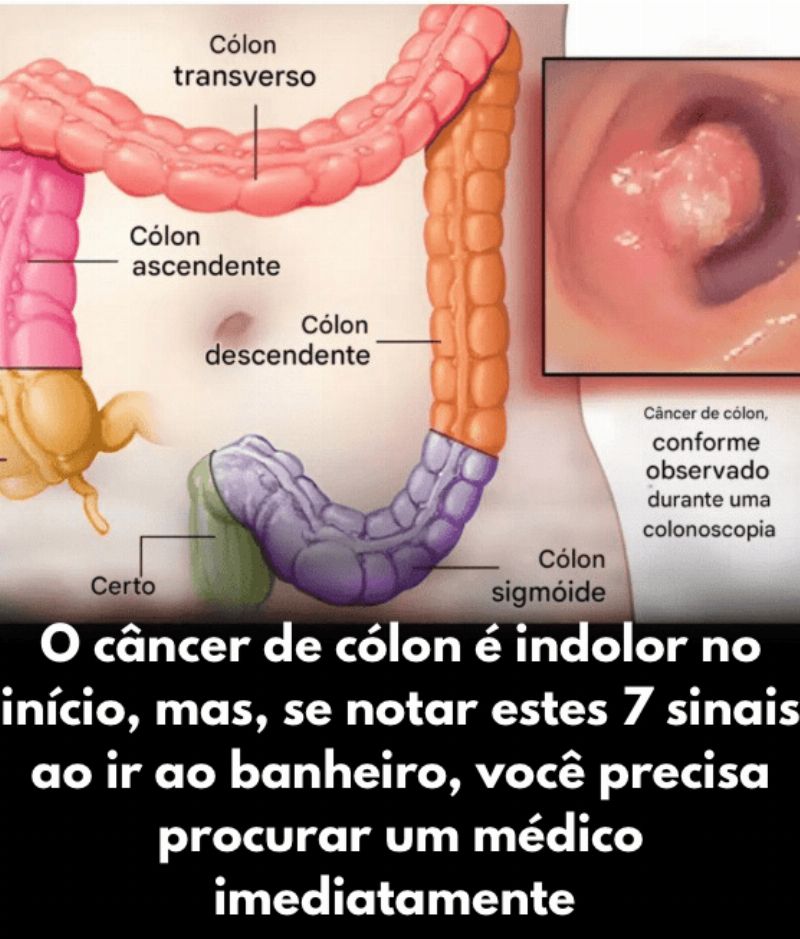 Imagem da Receita